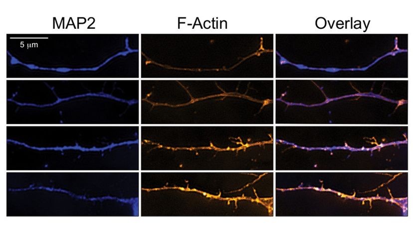 Rat neurons